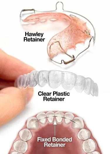 Different types of retainers