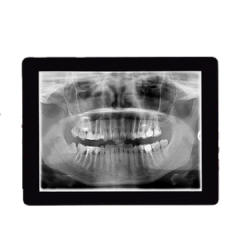 Digital Radiography