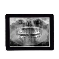 Digital Radiography